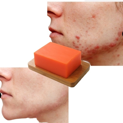 100g/140g/200g Anti Acne Soap Shower Soap Acne Soap Base Cleansing Kojic Acid Private Label